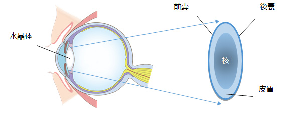 水晶体の拡大