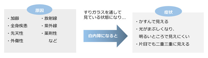 白内障の原因と症状